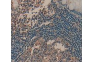 Image no. 3 for anti-Linker For Activation of T Cells (LAT) (AA 25-221) antibody (ABIN1868912)