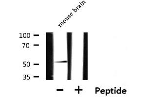 Image no. 1 for anti-Chemokine (C-X-C Motif) Receptor 7 (CXCR7) (Internal Region) antibody (ABIN6258040)