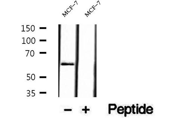 anti-Prolyl 4-Hydroxylase, alpha Polypeptide II (P4HA2) (Internal Region) antibody