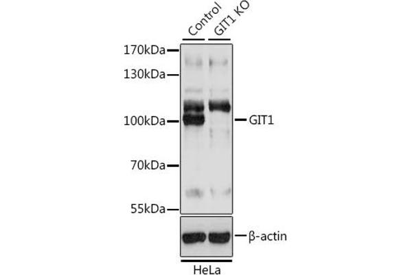 GIT1 antibody  (AA 460-640)