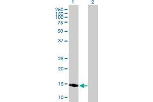 Image no. 1 for anti-Protein Phosphatase 1, Regulatory (Inhibitor) Subunit 1C (PPP1R1C) (AA 1-109) antibody (ABIN531020)