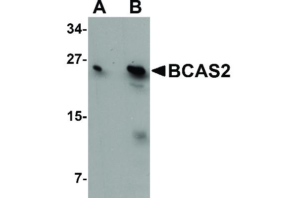 anti-Breast Carcinoma Amplified Sequence 2 (BCAS2) (C-Term) antibody
