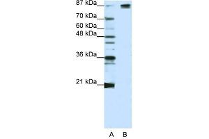 Image no. 2 for anti-Splicing Factor 3b, Subunit 1, 155kDa (SF3B1) (Middle Region) antibody (ABIN629905)