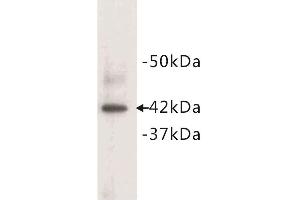 Image no. 1 for anti-Actin, Alpha, Cardiac Muscle 1 (ACTC1) (N-Term) antibody (ABIN1854822)