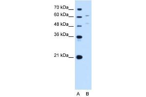 Image no. 1 for anti-UDP Glucuronosyltransferase 1 Family, Polypeptide A4 (UGT1A4) (N-Term) antibody (ABIN635830)