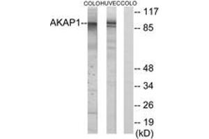 AKAP1 抗体  (AA 281-330)