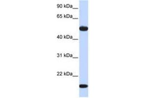 Image no. 1 for anti-Adenylosuccinate Synthase Like 1 (ADSSL1) (AA 144-193) antibody (ABIN6741031)