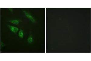 Image no. 3 for anti-Nuclear Factor of Activated T-Cells, Cytoplasmic, Calcineurin-Dependent 4 (NFATC4) (AA 642-691) antibody (ABIN1532367)