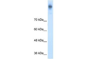 Image no. 1 for anti-Solute Carrier Family 12 (Potassium-Chloride Transporter) Member 2 (SLC12A2) antibody (ABIN630304)
