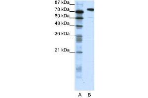 Image no. 1 for anti-SATB Homeobox 1 (SATB1) (C-Term) antibody (ABIN2780457)
