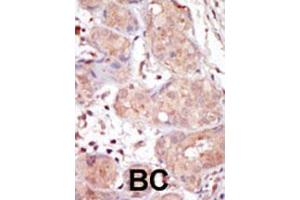 Image no. 2 for anti-Male Germ Cell-Associated Kinase (MAK) (AA 578-608), (C-Term) antibody (ABIN391782)