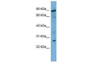 Image no. 1 for anti-Ubiquitin-Conjugating Enzyme E2F (UBE2F) (Middle Region) antibody (ABIN928641)
