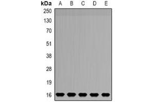 Image no. 2 for anti-NADH Dehydrogenase (Ubiquinone) 1 beta Subcomplex, 5, 16kDa (NDUFB5) (full length) antibody (ABIN6005834)