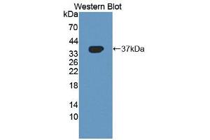 Image no. 1 for anti-Betaine--Homocysteine S-Methyltransferase (BHMT) (AA 11-314) antibody (ABIN1866896)