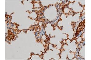 Image no. 8 for anti-Ezrin (EZR) (pTyr478) antibody (ABIN6255926)