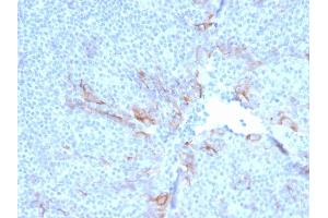 Image no. 4 for anti-Hepatitis A Virus Cellular Receptor 2 (TIM 3) (AA 22-202) antibody (ABIN6940963)