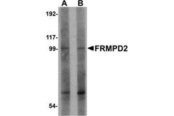 FRMPD2 antibody  (N-Term)