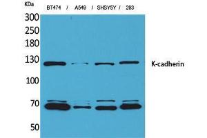 Image no. 2 for anti-K-Cadherin (CDH6) (Internal Region) antibody (ABIN3187664)