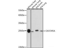 Western blot analysis of extracts of various cell lines using GADD45A Polyclonal Antibody at dilution of 1:1000.