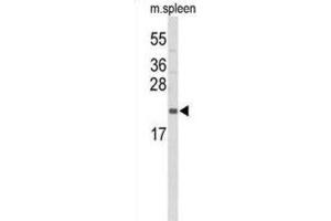 Image no. 3 for anti-Interleukin 31 (IL31) antibody (ABIN3004157)