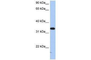 Image no. 1 for anti-Sulfotransferase Family, Cytosolic, 6B, Member 1 (SULT6B1) (C-Term) antibody (ABIN631168)