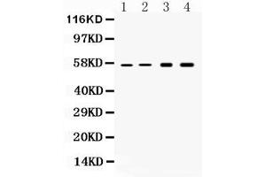 Image no. 3 for anti-Keratin 18 (KRT18) (AA 204-430) antibody (ABIN5518769)