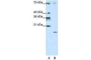 Image no. 3 for anti-Signal Recognition Particle 19kDa (SRP19) (Middle Region) antibody (ABIN2778840)