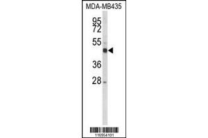 Western Blotting (WB) image for anti-Cytochrome P450, Family 21, Subfamily A, Polypeptide 2 (CYP21A2) antibody (ABIN2158436)