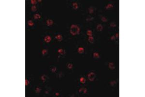 Image no. 2 for anti-Toll-Like Receptor 3 (TLR3) (N-Term) antibody (ABIN6655848)