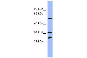 Image no. 1 for anti-Proteasome (Prosome, Macropain) 26S Subunit, ATPase, 4 (PSMC4) (N-Term) antibody (ABIN2774159)