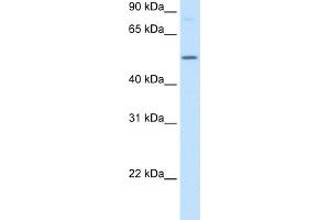 Image no. 3 for anti-Betaine--Homocysteine S-Methyltransferase (BHMT) (N-Term) antibody (ABIN2773785)