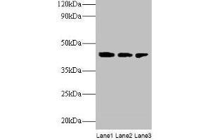 Western blot All lanes: ILKAP antibody at 2 μg/mL Lane 1: Rat kidney tissue Lane 2: U251 whole cell lysate Lane 3: Mouse stomach tissue Secondary Goat polyclonal to rabbit IgG at 1/10000 dilution Predicted band size: 43 kDa Observed band size: 43 kDa