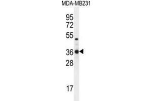Image no. 2 for anti-Tryptase delta 1 (TPSD1) (AA 171-201), (C-Term) antibody (ABIN955305)