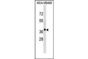Image no. 1 for anti-Lysophosphatidic Acid Receptor 4 (LPAR4) (AA 126-156), (Middle Region) antibody (ABIN953970)