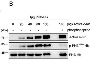 c-Kit phosphorylates PHB at tyrosine 259.