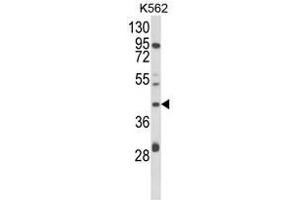 Image no. 1 for anti-Coenzyme Q3, Methyltransferase (COQ3) (Middle Region) antibody (ABIN453581)