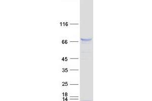 Image no. 1 for Syntaphilin (SNPH) protein (Myc-DYKDDDDK Tag) (ABIN2733105)