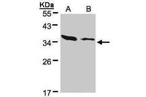 Image no. 5 for anti-Actin Related Protein 2/3 Complex, Subunit 2, 34kDa (ARPC2) (Center) antibody (ABIN2855249)