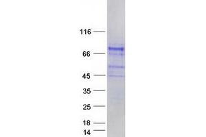 Image no. 1 for SHC (Src Homology 2 Domain Containing) Family, Member 4 (SHC4) protein (Myc-DYKDDDDK Tag) (ABIN2731994)