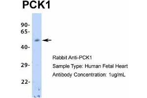 Image no. 10 for anti-phosphoenolpyruvate Carboxykinase 1 (Soluble) (PCK1) (Middle Region) antibody (ABIN2777603)
