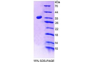 Image no. 1 for Latrophilin 2 (LPHN2) (AA 139-398) protein (His tag) (ABIN6238683)