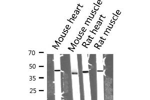 Image no. 2 for anti-Actin, alpha 1, Skeletal Muscle (ACTA1) antibody (ABIN6259745)