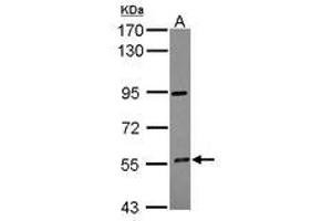 Image no. 1 for anti-Cytochrome P450, Family 4, Subfamily F, Polypeptide 12 (CYP4F12) (AA 133-322) antibody (ABIN1497740)