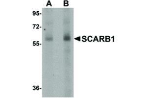 Image no. 1 for anti-Scavenger Receptor Class B, Member 1 (SCARB1) (N-Term) antibody (ABIN6656146)