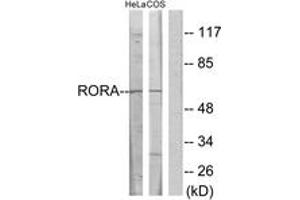 Image no. 1 for anti-RAR-Related Orphan Receptor A (RORA) (AA 6-55) antibody (ABIN1533707)
