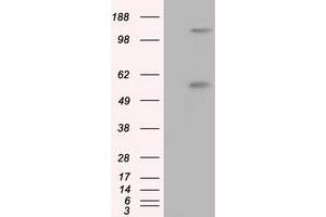 Image no. 3 for anti-Atrial Natriuretic Peptide Receptor 3 (NPR3) antibody (ABIN2727509)
