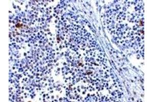 Image no. 1 for anti-Interferon Induced with Helicase C Domain 1 (IFIH1) (Middle Region) antibody (ABIN1031000)