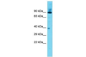 Host: Rabbit Target Name: DPY19L3 Sample Type: Fetal Heart lysates Antibody Dilution: 1.