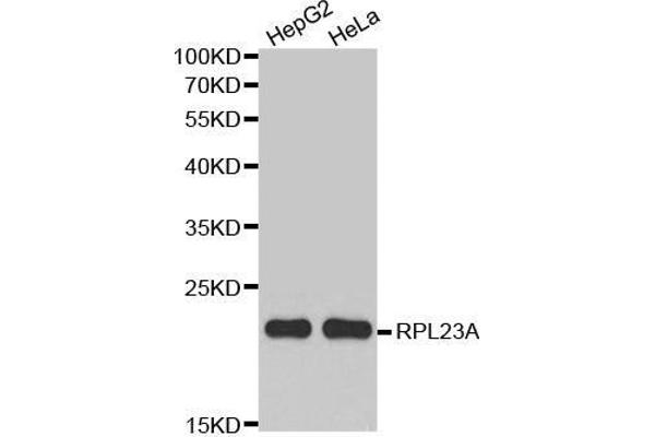 RPL23A Antikörper  (AA 1-156)