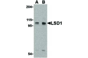 Image no. 1 for anti-Lysine (K)-Specific Demethylase 1A (KDM1A) (Internal Region) antibody (ABIN6656909)